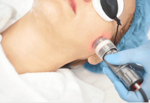 Screenshot 2025-03-08 at 9.32.29 AM